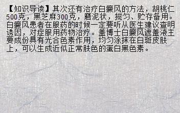 【百姓康】关节性白癜风 做白癜风检查需要空腹吗_兰州新闻网_名医名院